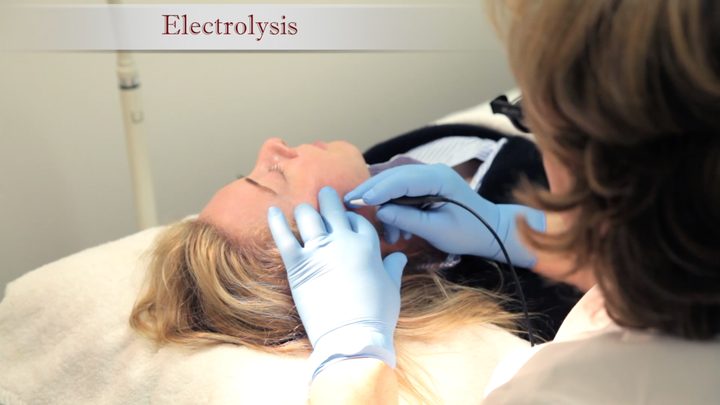 An electrologist at Berenice treating a client's face with a fine electrolysis probe